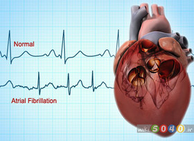 1464684824709_1414398820