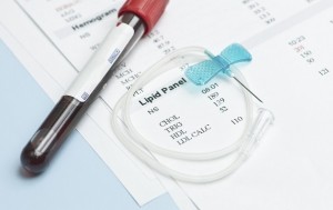 Lipid Panel