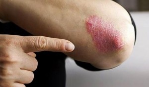 avayezendegi_skin_001