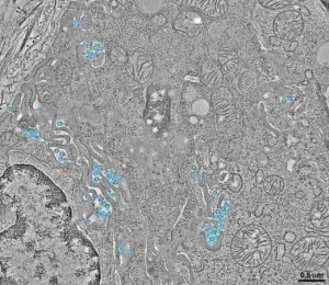 اولین تصویر سه‌بعدی از ویروس اچ‌آی‌وی
