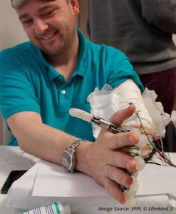 اولین دست مصنوعی جهان