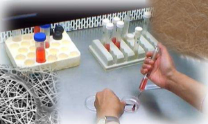 بهبود استحکام بافت استخوانی با روش زیست سازگار محققان ایرانی