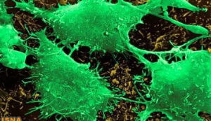 تشخیص بافت تومور از سالم