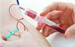 تعیین سطوح مس در خون برای تشخیص آلزایمر!