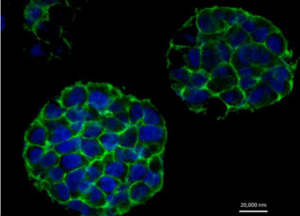 توسعه درمان‌های جدید سرطان با چاپ سه‌بعدی تومور