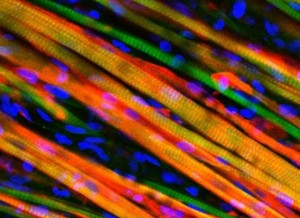 تولید عضله مصنوعی خودترمیم‌گر با عملکرد واقعی