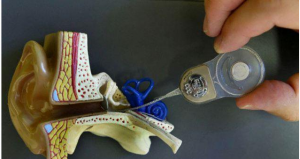 جهان از دید یک ناشنوا چگونه است