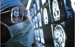 دیابت نوع 2 مغز را پیر می‌کند