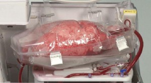 ساخت دستگاه زنده نگهدارنده عضو پیوندی