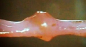 ساخت مینی‌قلب آزمایشگاهی قابل رشد در بدن