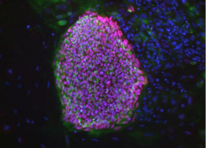 شبیه‌سازی سلول‌های بنیادی برای درمان دیابت!