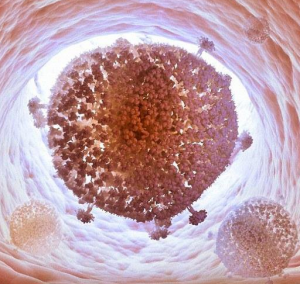 نخستین موفقیت دانشمندان در حذف ویروس اچ‌آی‌وی از دی‌ان‌ای