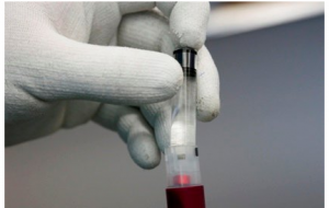 پیش‌بینی زودتر از موعد افت قند خون با مدل ریاضیاتی