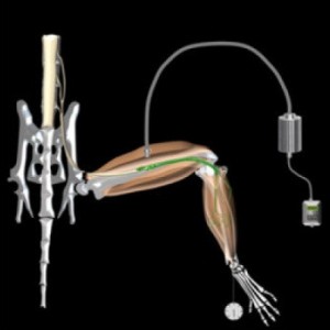 کنترل‌ عضلات فلج با نور